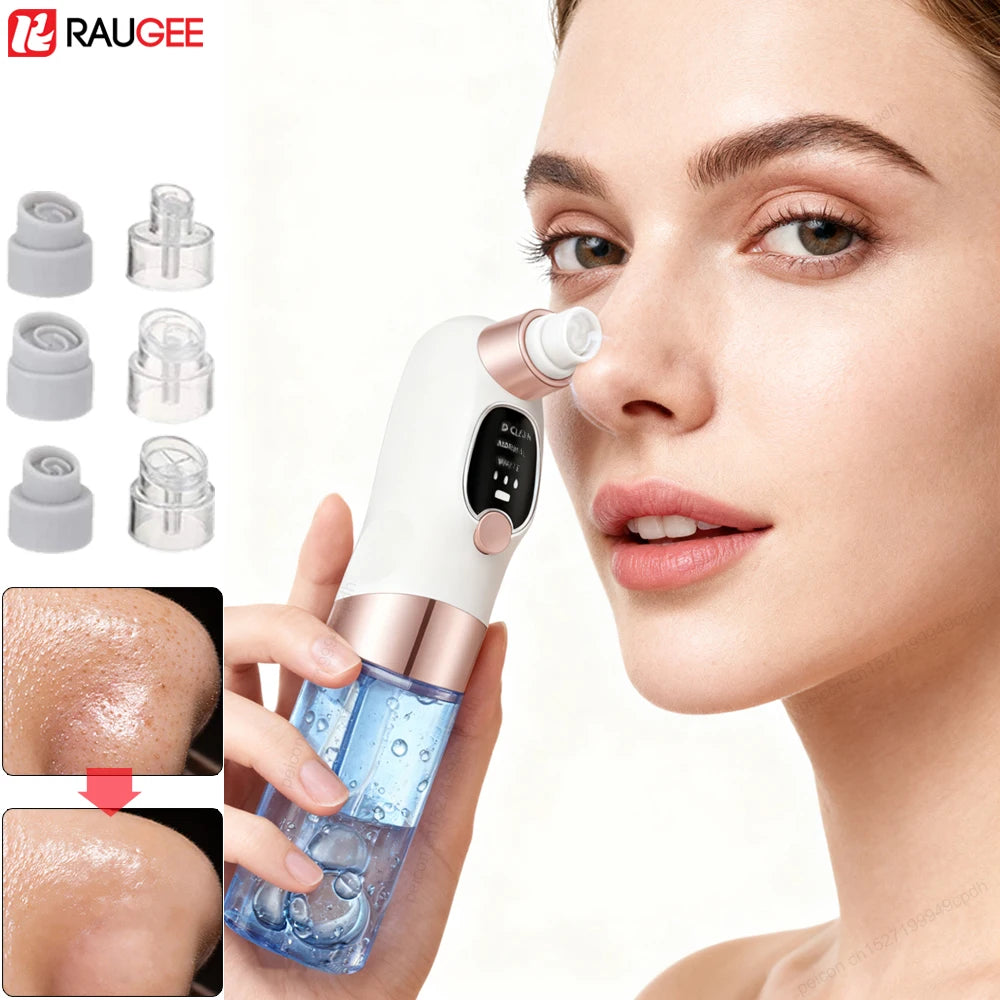 Electric Blackhead Remover – Deep Pore Cleaner