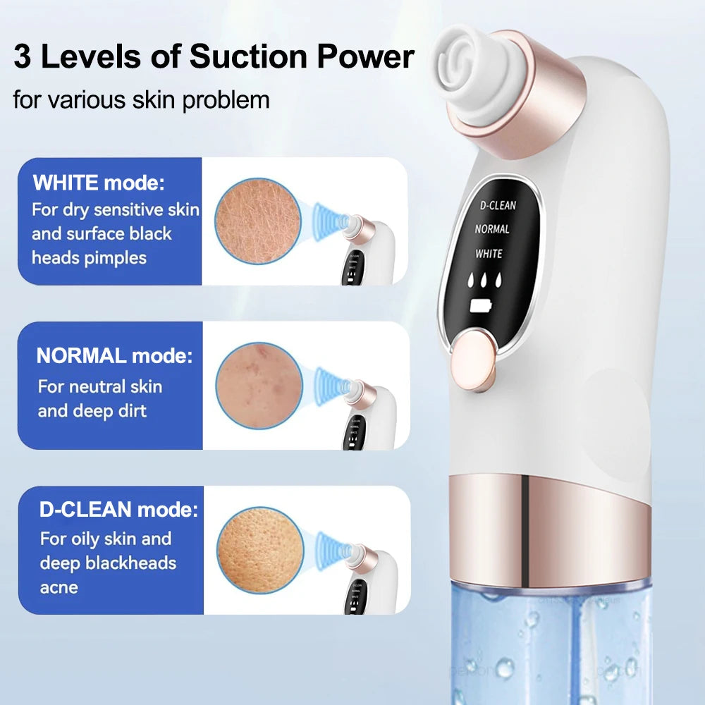 Electric Blackhead Remover – Deep Pore Cleaner