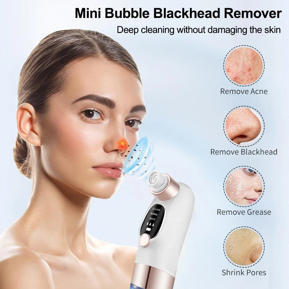Electric Blackhead Remover – Deep Pore Cleaner